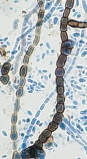 Aureobasidium pullulans. © Dr. David Ellis, The Univerisity of Adelaide.